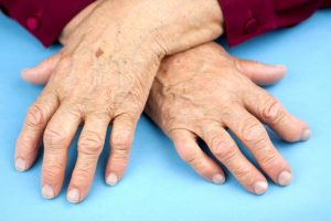 артрит у пожилых